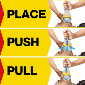 LifeVac Anti Choking Device Home Kit